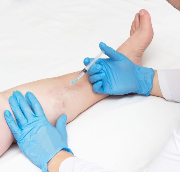 what kind of doctor is a vein specialist