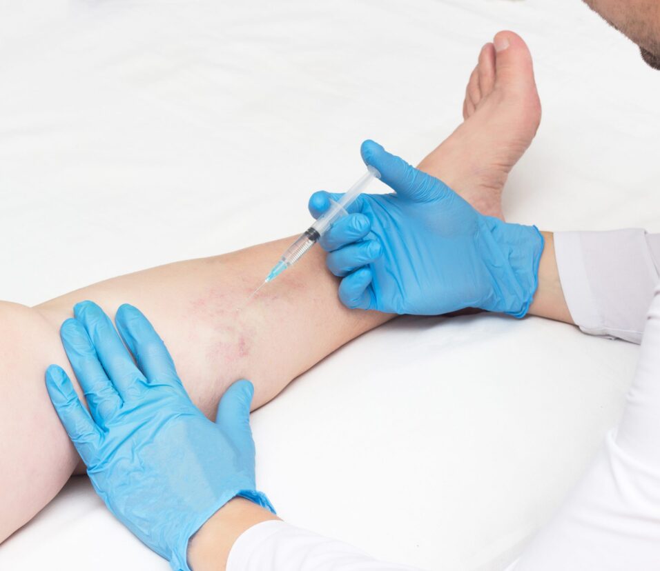 what kind of doctor is a vein specialist