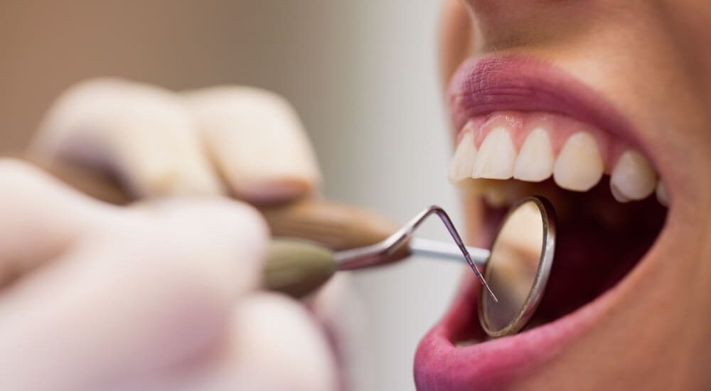 root canal