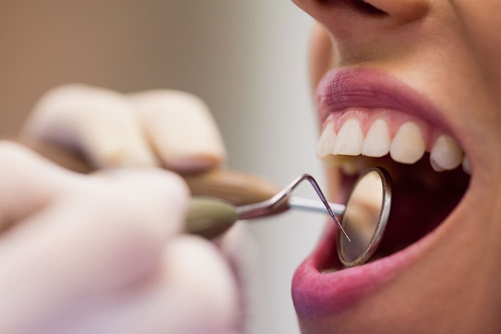 root canal