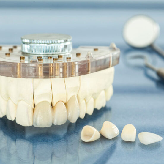 houston texas veneers