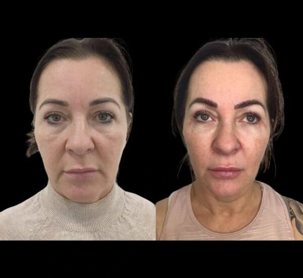 Best Plastic Surgeon in dubai