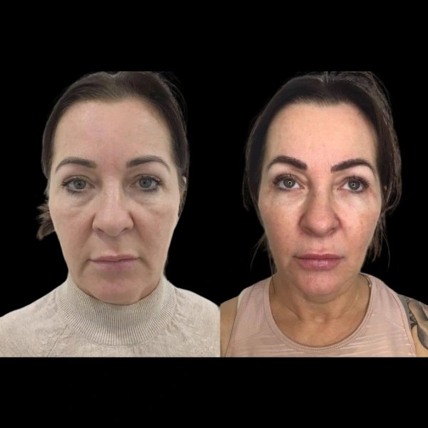 Best Plastic Surgeon in dubai